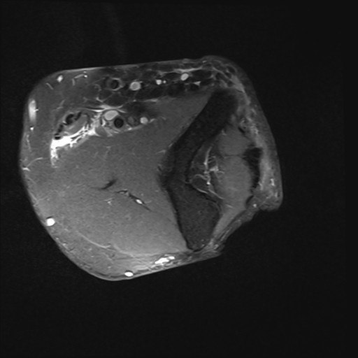 Click on the Serie image to view the images of Wieszt, Gnter